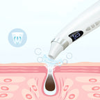 Visual Pore Vacuum with Skin Camera – view 3