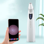 Visual Pore Vacuum with Skin Camera – view 2