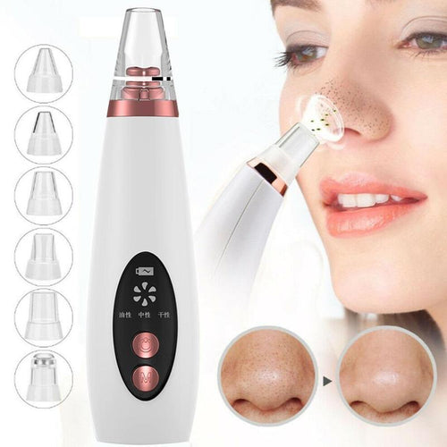 Blackhead Pore Vacuum – 6-Tip Deep Cleaning Kit - RLXDSKIN